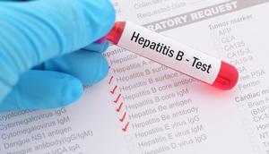 Test hepathite B
