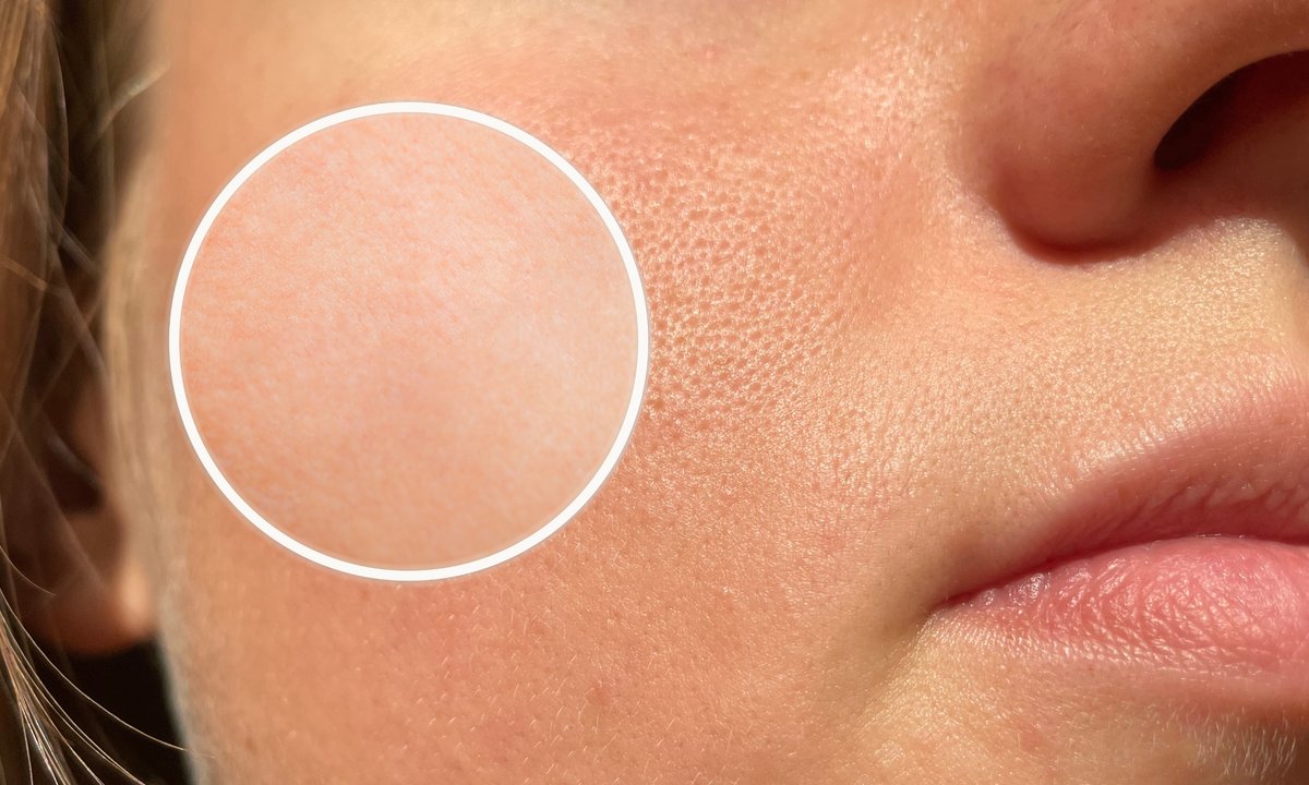 Maska napakowana drożdżami to zbawienie dla tłustej, zaczopowanej cery. Czyści pory jak dłonie kosmetyczki