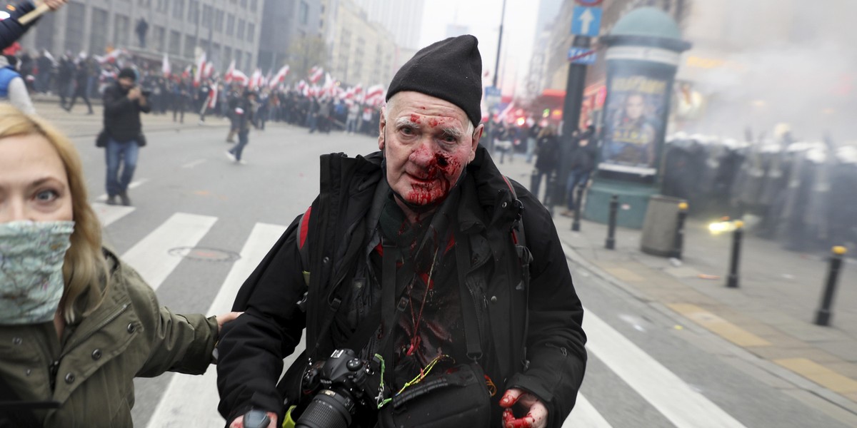 Policja zajmie się sprawą postrzelonego fotoreportera