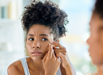 Acne Myths and Misconceptions: What you should and shouldn't believe