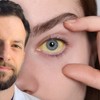 Žutica sama po sebi nije dijagnoza, ona je znak da treba pronaći uzrok, kaže dr Stevan Milenković 