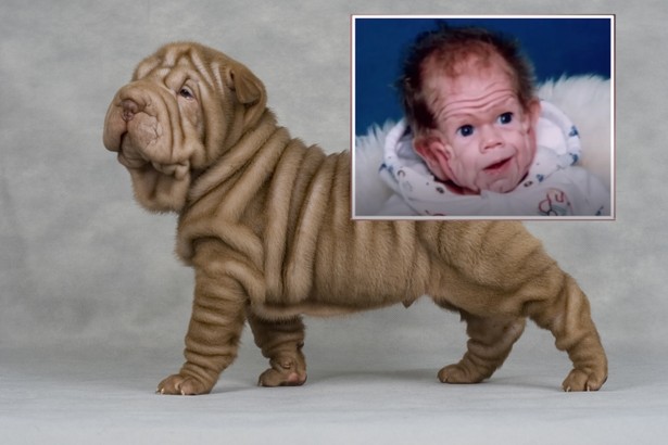 Gdy się urodził, miał skórę jak shar pei. Jak wygląda po 30 latach?