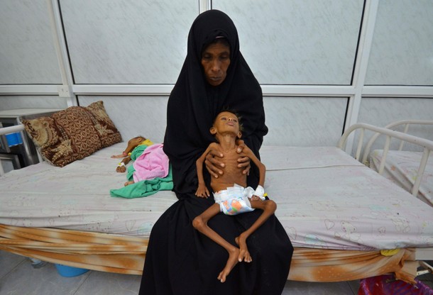 The Wider Image: Risk of famine looms in Yemen