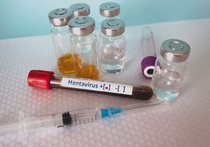 Hantavirus može da ošteti srce, pluća i druge organe