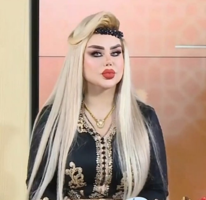Dalija je imala više od 43 plastične operacije