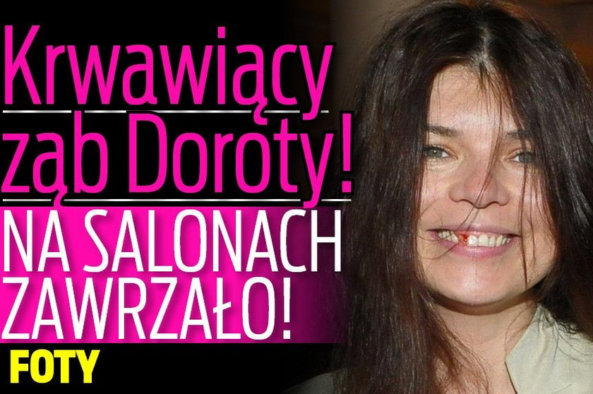 Krwawiący ząb Doroty! Na salonach zawrzało! FOTY