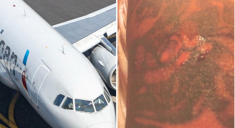 An American Airlines plane; George Latorre's damaged tattoo.Nicolas Economou/NurPhoto via Getty Images; lawsuit