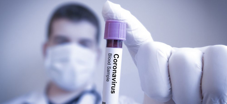Ile osób na całym świecie zaatakował koronawirus? NAJNOWSZE DANE