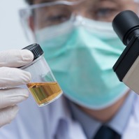 Vizeletvizsgálattal is ki lehet szűrni a méhnyakrákot okozó HPV-vírust