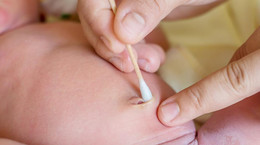 Kikut pępowinowy - pielęgnacja pępka noworodka. Co zrobić, gdy ropieje?