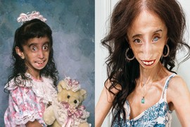 Kažu da je NAJRUŽNIJA ŽENA NA SVETU: Nema ni 30 kila, BRUTALNO JE VREĐAJU, a njena priča zapravo je predivna