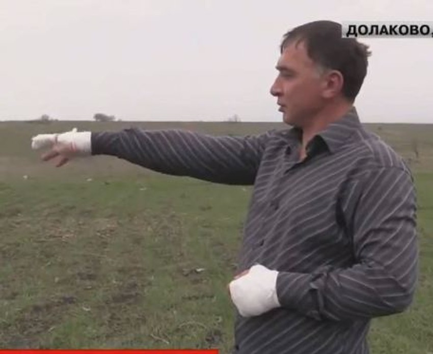 Aslanu Šauhalovu vuk je izujedao šake