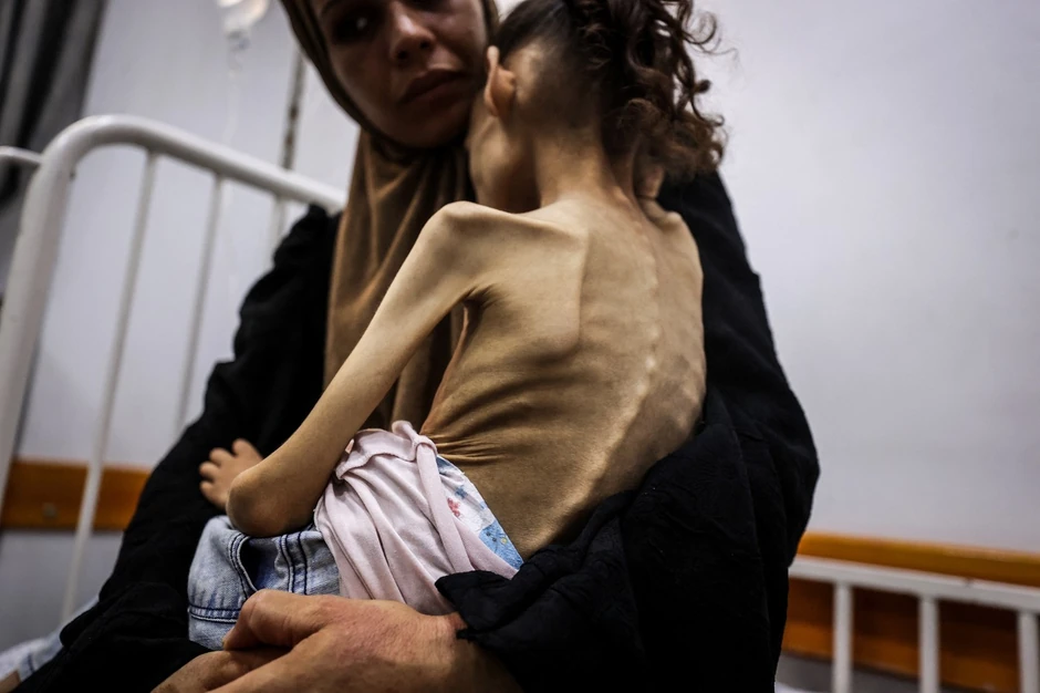 Malena Marjam je toliko mršava da joj se ocrtavaju kičma i rebra