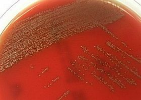 bakterium-s-tigurinus-d0000127D0c7e9255da97
