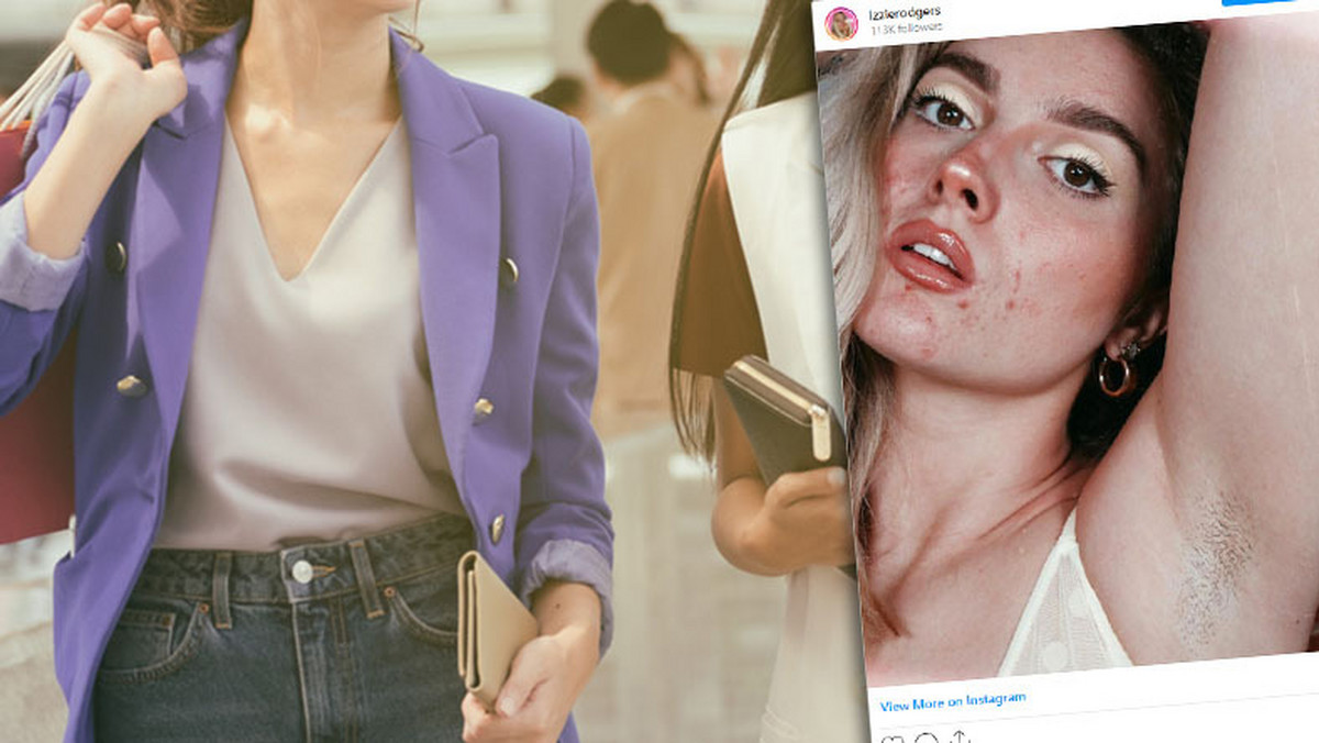 Modelka z trądzikiem reklamuje popularną markę ASOS. Kobiety jej dziękują