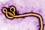 Wirus Ebola wirusy choroby zdrowie epidemie