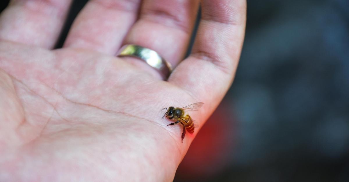 Uzadlenia Szerszenia Pszczoly Osy Trzmiela Jak Postepowac Po Ukaszeniu