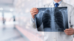 Obrzęk płuc - główna przyczyna niewydolności lewej komory serca