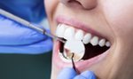 NFZ przestanie płacić za dentystów? 