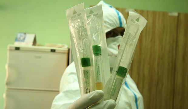 virus-korona-labaratorija-institut-za-javno-zdravstvo-38-foto-S-PASALIC