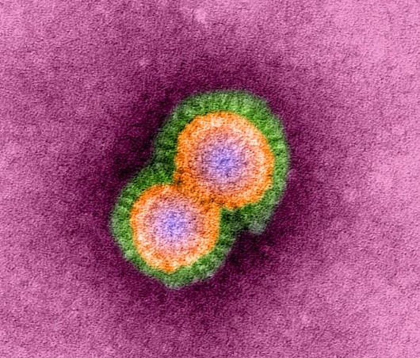 Topola Osiedle: wirus ptasiej grypy, do zabicia 65 tys. kur