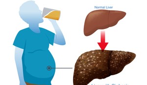 Vikend opijanje je štetnije za jetru nego isti broj pića raspoređen tokom nedelje