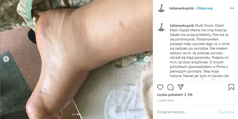 Tatiana Okupnik pokazała zdjęcia po porodzie / Instagram Tatiany Okupnik