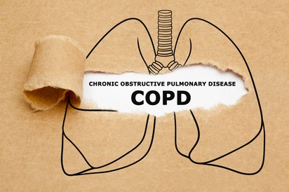 Így változtassa meg az étkezési szokásait, ha COPD-je van