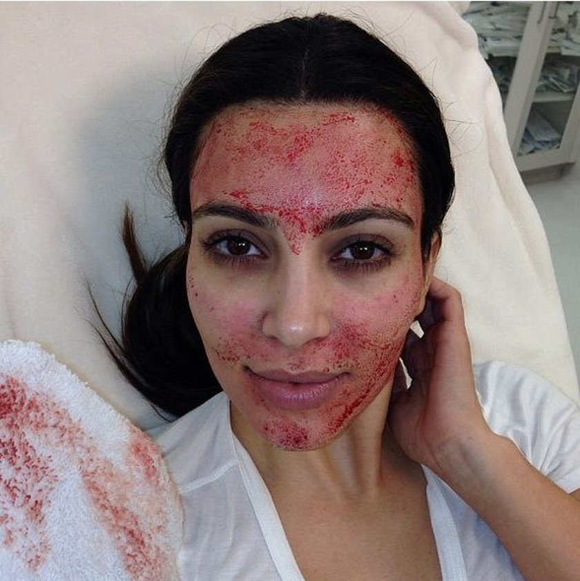 Kim Kardashian z krwią na twarzy