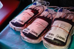 Krwawy quiz. Ta wiedza może ci uratować życie QUIZ