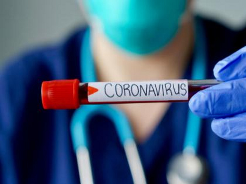 Studenci, którzy mają objawy ze strony układu oddechowego i nie podróżowali do rejonów objętych koronawirusem, zostali poproszeni o udanie się do lekarza i weryfikację stanu zdrowia.