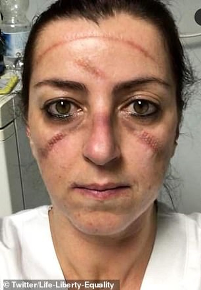 Mnogi italijanski lekari i medicinske sestre nakon napornog radnog dana izgledaju ovako