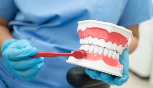 Redovnom i pravilnom oralnom higijenom smanjuje se razvoj bakterije Porphyromonas gingivalis, koja i jeste krivac Alchajmerove bolesti 