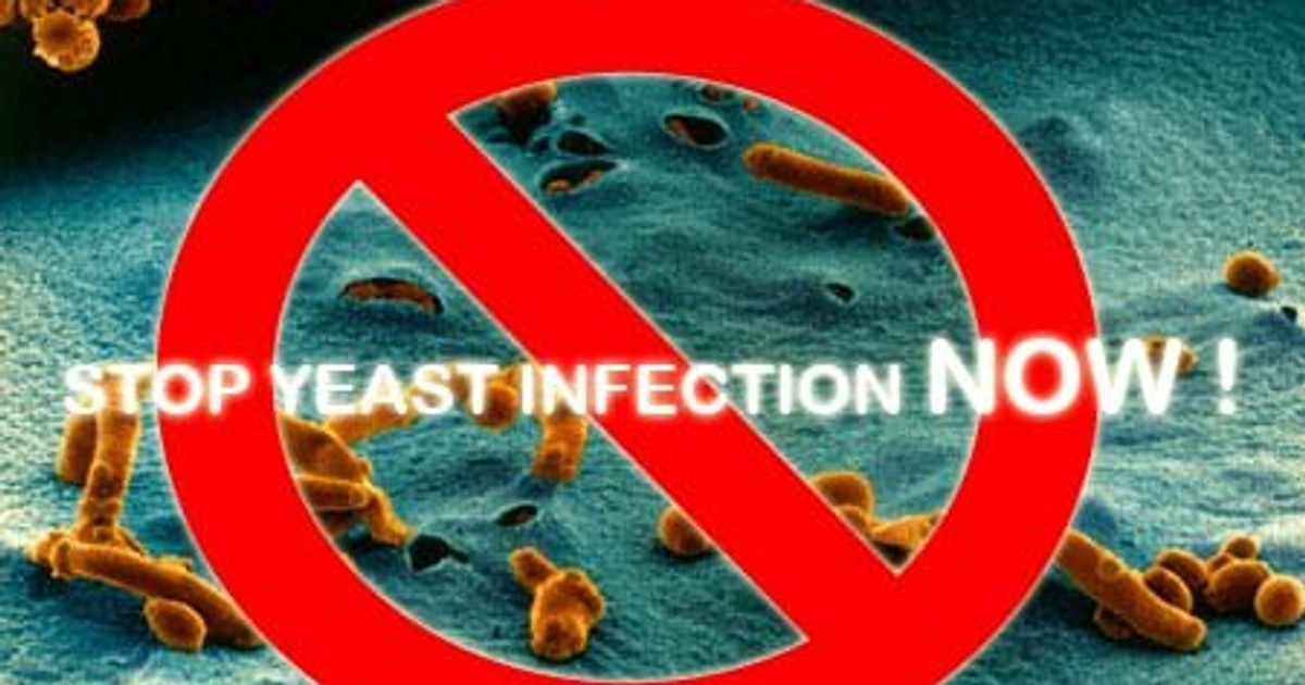 10 things to know about yeast infection Pulse Nigeria