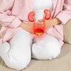 Komplikovane infekcije urinarnog trakta su mnogo ozbiljnije i teže za lečenje