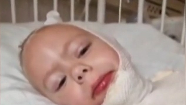 Szörnyű baleset: forró olajba esett egy 4 éves kisfiú Zombán, a ruhája szinte teljesen a bőrébe égett – videó