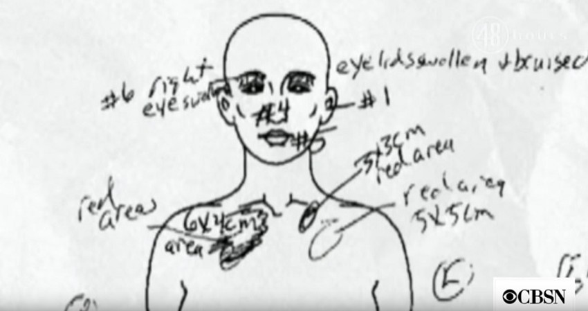 Kejlino telo bilo je puno povreda