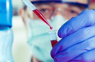 Strata netto Biomedu wyniosła 37,24 mln zł w 2015 r. wobec zysku rok wcześniej