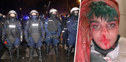 "Obficie krwawię i pluję krwią". Protestująca na Strajku Kobiet oskarża policjanta o straszne rzeczy