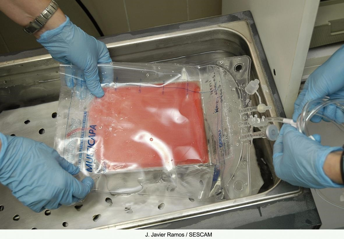 Curan el VIH en un paciente de 60 años: seis años sin virus tras trasplante