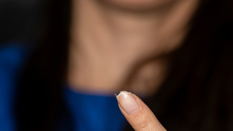 korom toredezés oka betegség