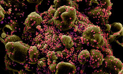Jak wirusy &quot;oszukują&quot; układ odpornościowy? Naukowcy znaleźli odpowiedź