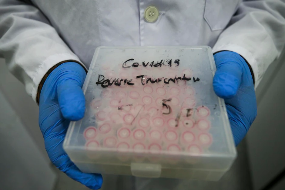 Masovno testiranje u Velikoj Britaniji