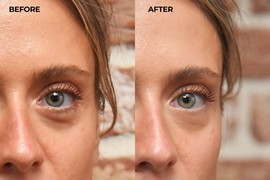 Imam 44 godine i mislila sam da će KESICE ISPOD OČIJU zauvek ostati tu – a onda sam probala ovaj trik i za 15 minuta NISAM MOGLA DA POVERUJEM šta vidim u ogledalu