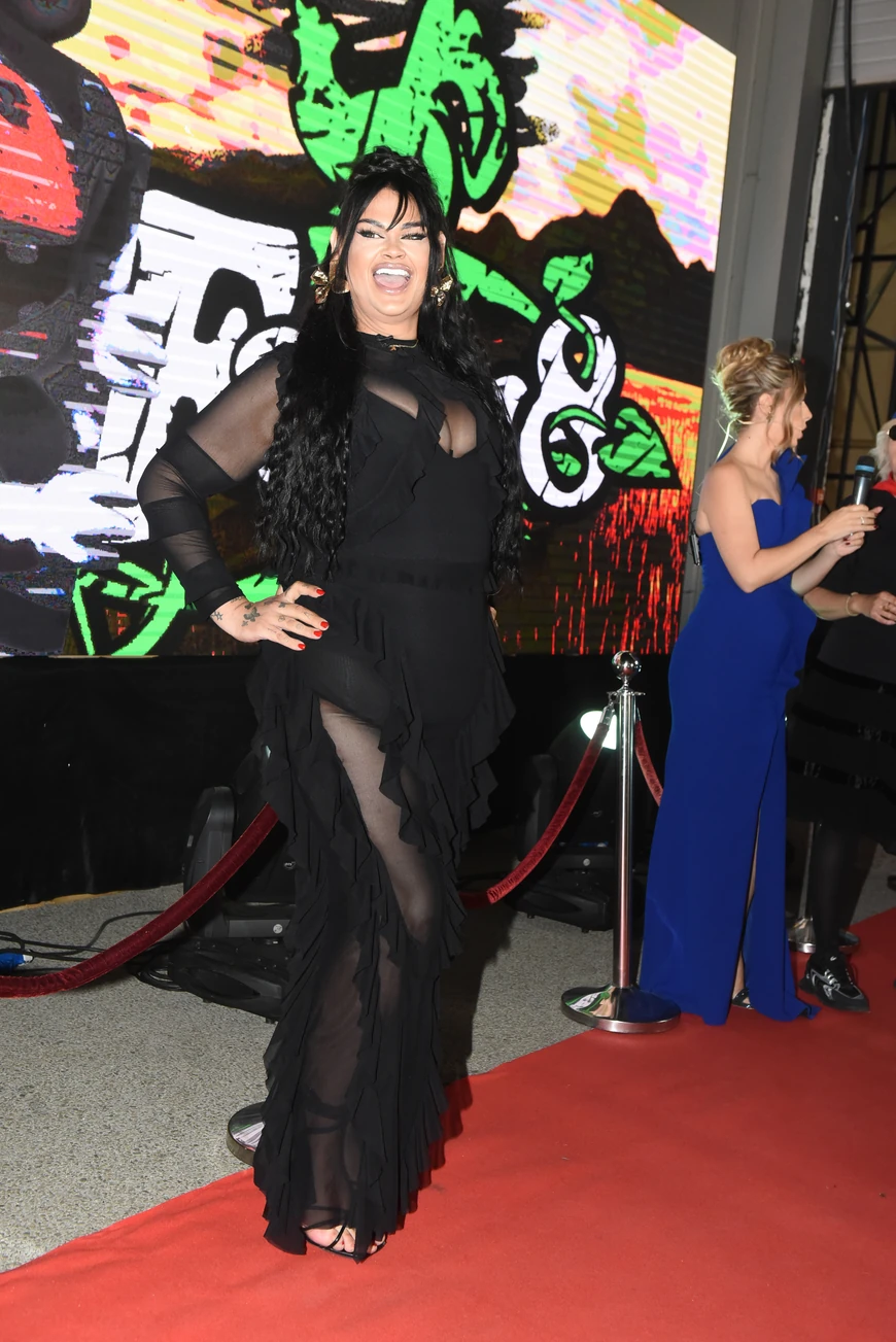 "DEKICA IZ NEMAČKE PLAĆA OPERACIJE" Transrodna Kiki Star šokirala: "413.000 sam dala za butine"