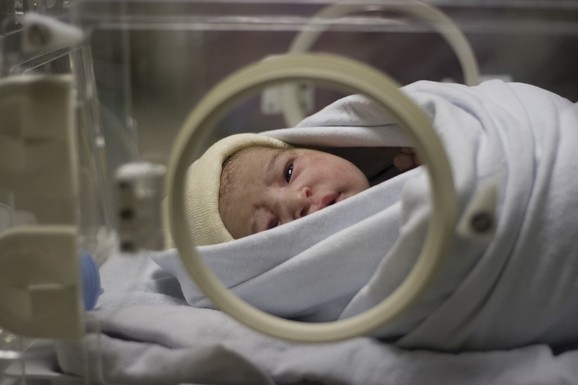 Šta je lanugo i zašto se bebe rađaju sa nežnim dlačicama