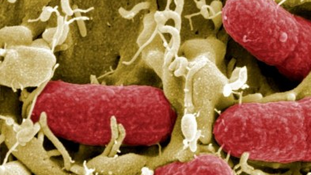 Bakteria E.coli