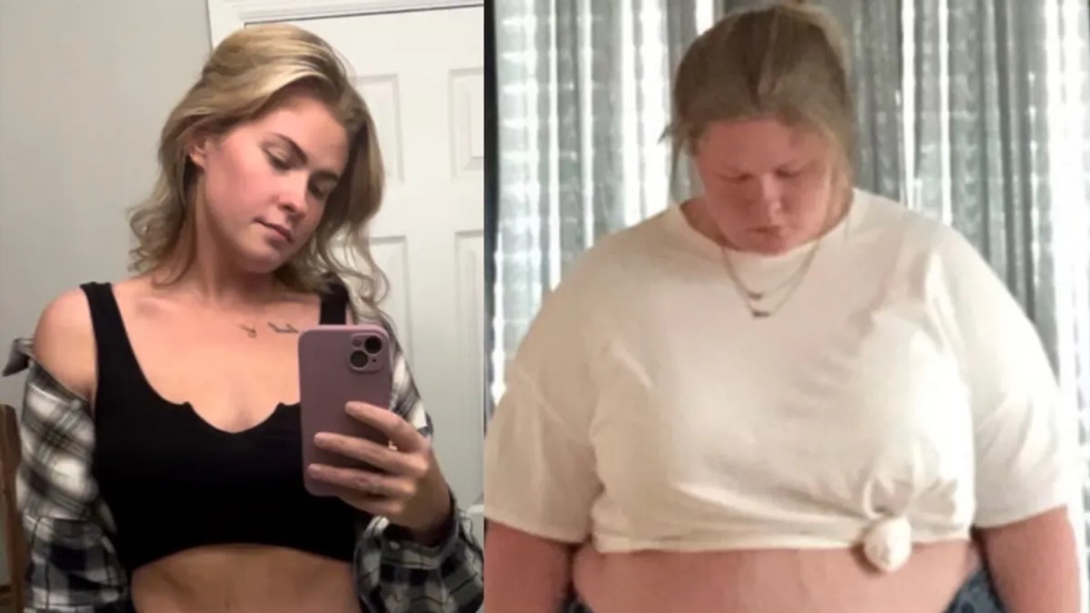 Smršala 128 kilograma, sad pokazala kako izgleda