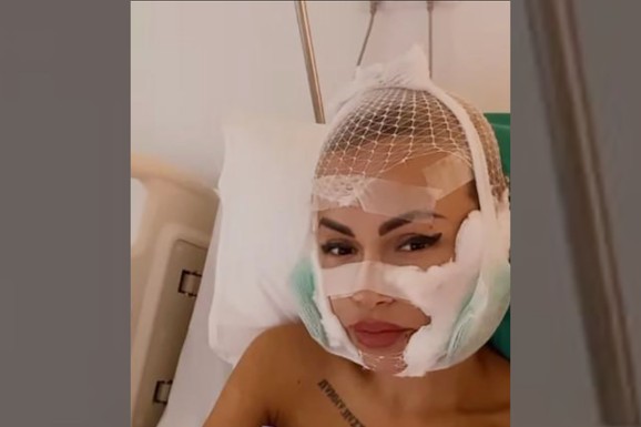 DANAS JE NIKO NE PREPOZNAJE Dala 15.000 evra na operacije i nestala iz javnosti: Evo kako sada izgleda nekadašnja rijaliti učesnica