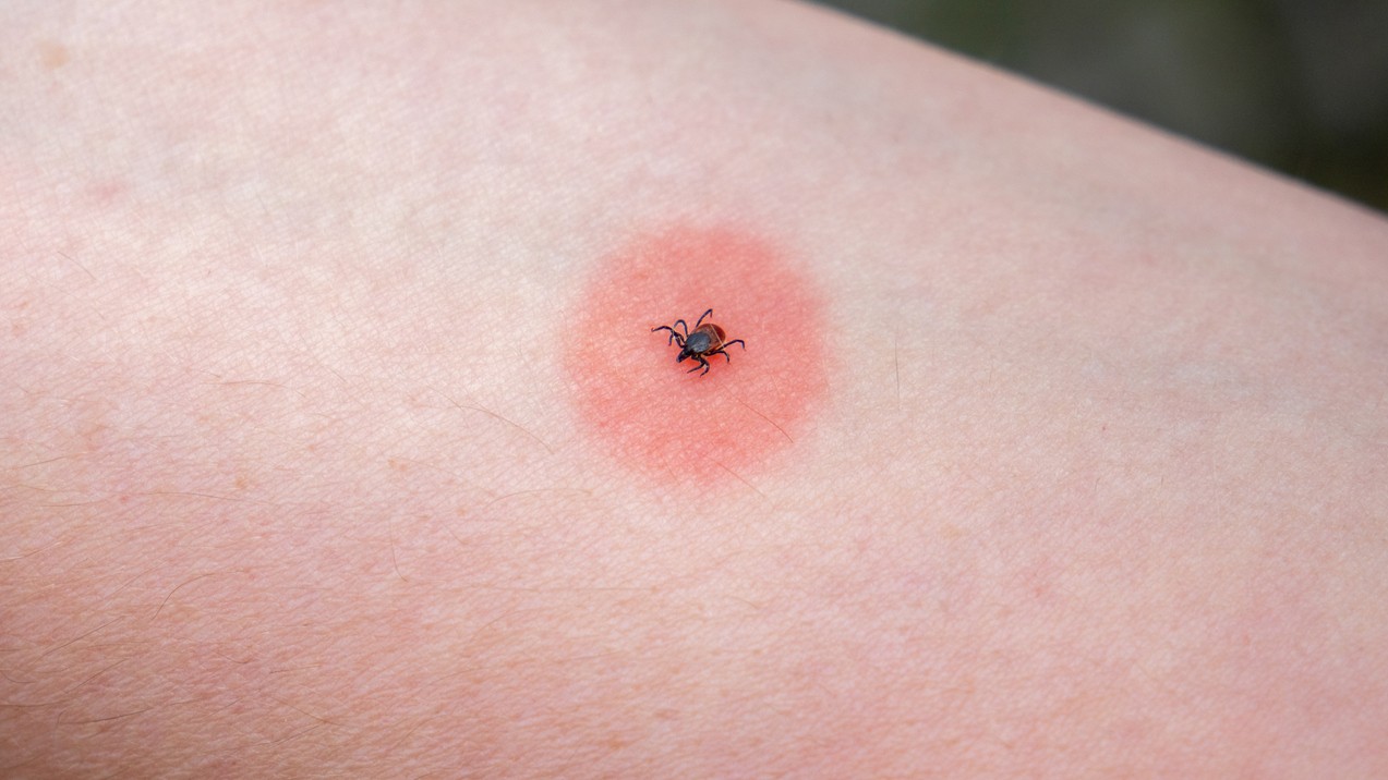 Klimatické zmeny uvoľňujú cestu nebezpečným druhom kliešťov.